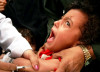 measles death toll climbs to 13 in villages near hyd measles death toll climbs to 13 in villages near hyd