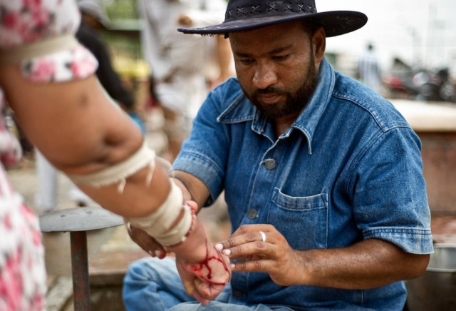 mohammed iqbal son of elderly doctor mohammed gyas applies cuts to the arm of an indian woman at their open air clinic outside the jama masjid in the old quarters of delhi among a handful of poorer and sometimes remote communities in india traditional practices like bloodletting are favoured photo afp
