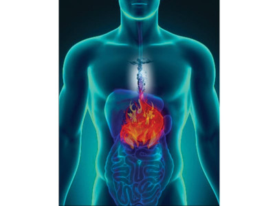 do you have an acidity problem