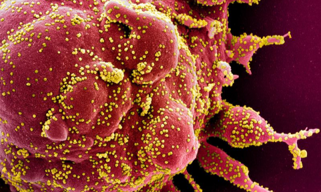 colorized scanning electron micrograph of an apoptotic cell red infected with sars cov 2 virus particles yellow also known as novel coronavirus isolated from a patient sample image captured at the niaid integrated research facility irf in fort detrick maryland national institute of allergy and infectious diseases nih handout via reuters colorized scanning electron micrograph of an apoptotic cell red infected with sars cov 2 virus particles yellow also known as novel coronavirus isolated from a patient sample image captured at the niaid integrated research facility irf in fort detrick maryland national institute of allergy and infectious diseases nih handout via reuters