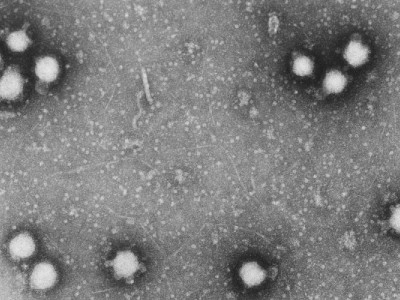 precautionary measures health officials prepare to tackle congo virus