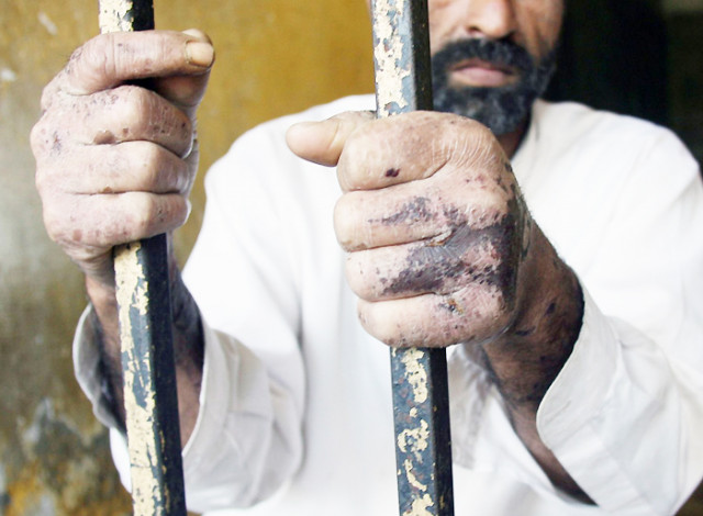 file photo of the impact of just a small quantity of acid on the hands arms photo afp file file photo of the impact of just a small quantity of acid on the hands arms photo afp file