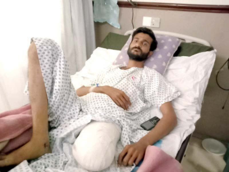 aqeel ahmed lies on a hospital bed after amputation of his leg ahmed was allegedly shot in the leg by a policeman when he tried to stop vaccinators from administering the anti polio vaccine to children in his neighbourhood photo express