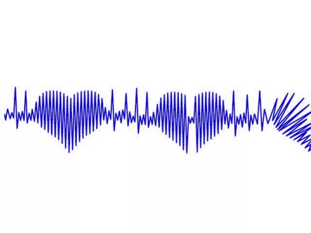 the theme of the conference is cardiac pacing and clinical electro physiology the theme of the conference is cardiac pacing and clinical electro physiology