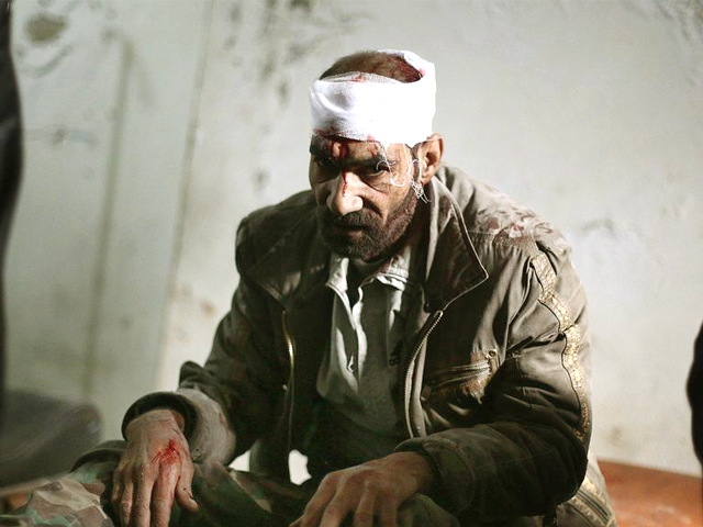 a syrian local waiting at a make shift hospital in the rebel held damascus suburb of douma photo afp