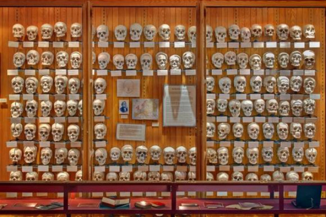 the hyrtl skull collection is photographed in the mutter museum of the college of physicians of philadelphia in philadelphia pennsylvania june 11 2009 in this handout image released to reuters on december 11 2013 photo reuters the hyrtl skull collection is photographed in the mutter museum of the college of physicians of philadelphia in philadelphia pennsylvania june 11 2009 in this handout image released to reuters on december 11 2013 photo reuters