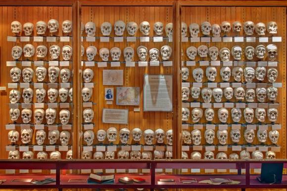 the hyrtl skull collection is photographed in the mutter museum of the college of physicians of philadelphia in philadelphia pennsylvania june 11 2009 in this handout image released to reuters on december 11 2013 photo reuters