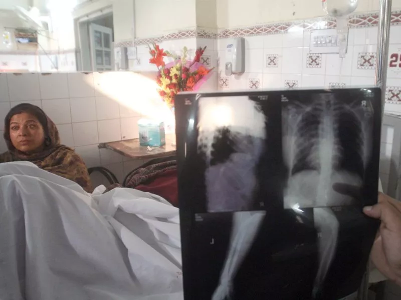 salma bibi is the lone survivor of the attack on the polio teams that claimed the lives of three of her colleagues photo athar khan express salma bibi is the lone survivor of the attack on the polio teams that claimed the lives of three of her colleagues photo athar khan express
