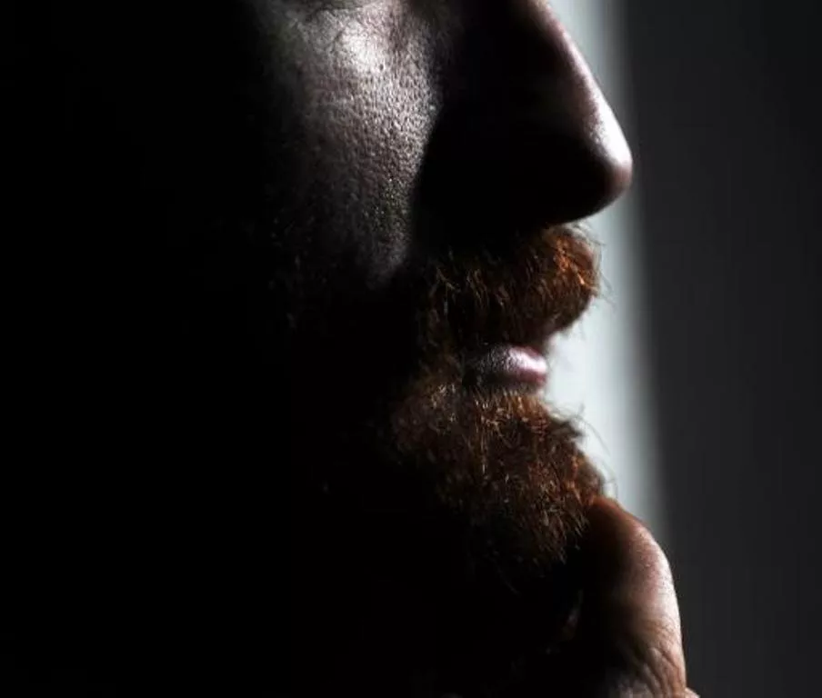 some smooth faced young men ask for bushy beards others are looking for soul patch says comestic surgeon charles photo afp some smooth faced young men ask for bushy beards others are looking for soul patch says comestic surgeon charles photo afp