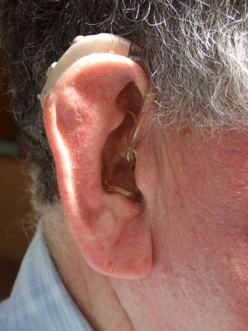 file photo of a hearing aid photo file file photo of a hearing aid photo file