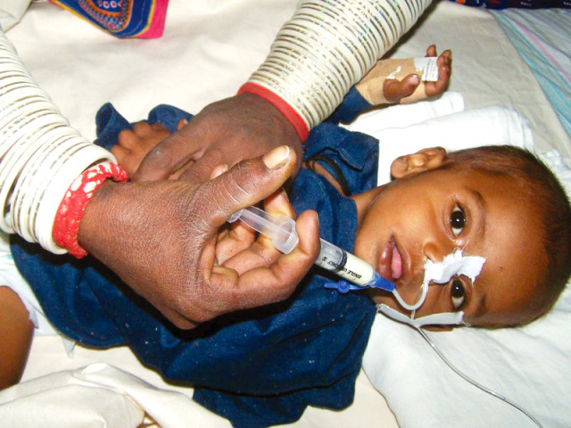 a child affected by malnutrition in thar is being treated at the civil hospital in hyderabad photo inp a child affected by malnutrition in thar is being treated at the civil hospital in hyderabad photo inp