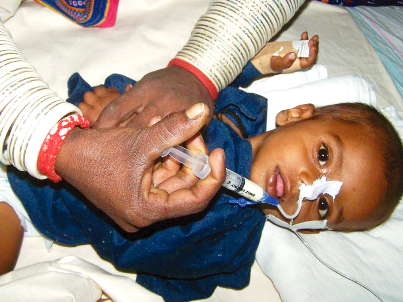 a child affected by malnutrition in thar is being treated at the civil hospital in hyderabad photo inp