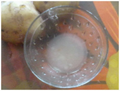 home remedies for acne home remedies for acne