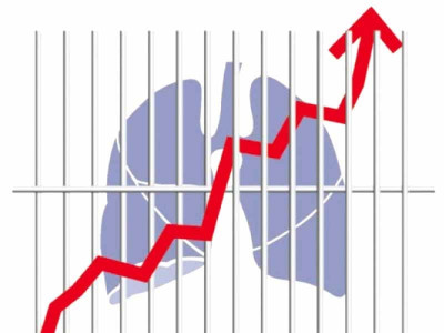 fund starved staff go without salary at tb control programme