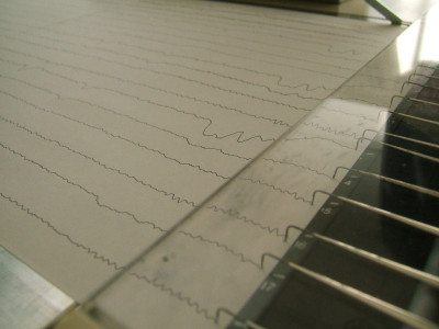 neurology conference 10 of pakistanis suffer from neurological disorders