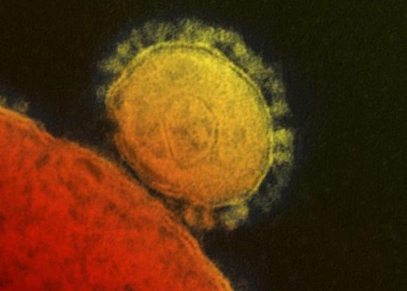 the middle east respiratory syndrome mers coronavirus is seen in an undated transmission electron micrograph from the national institute for allergy and infectious diseases niaid photo reuters