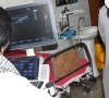 k p govt hospitals lose key radiologist