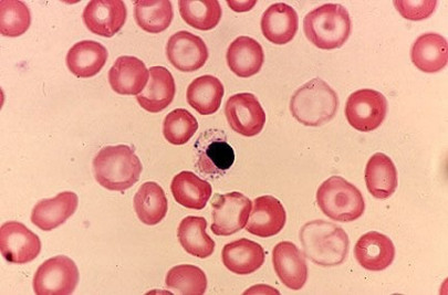 a vital donation bb s blood drive helps thalessaemia children