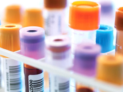 the walking wounded 37 faisalabad cops diagnosed with hepatitis the walking wounded 37 faisalabad cops diagnosed with hepatitis