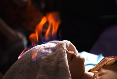 burn patient burn medical inferno in china