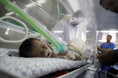 gaza miracle baby dies due to over complications power cuts