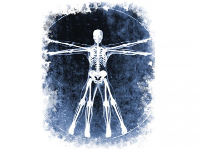 rising trend timely osteoporosis diagnosis can help avoid fractures