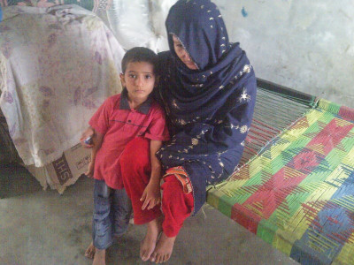 a haunting experience a year on acid attack victims relive the horror every day a haunting experience a year on acid attack victims relive the horror every day