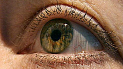 woman who gouged her eyes in california sues over viral photo