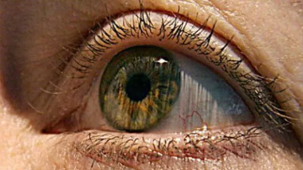 woman who gouged her eyes in california sues over viral photo woman who gouged her eyes in california sues over viral photo