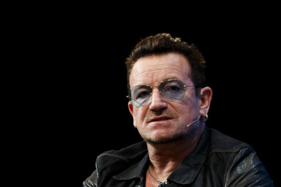 u2 s bono fitted with metal plates screws after bike accident u2 s bono fitted with metal plates screws after bike accident