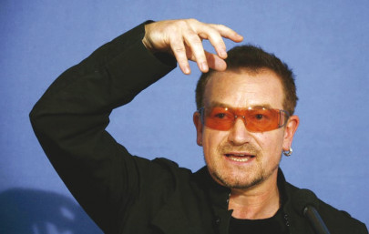 u2 s bono fitted with metal plates screws after bike accident u2 s bono fitted with metal plates screws after bike accident