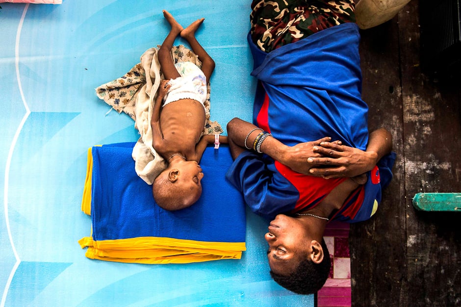 A mother and her three year-old sick child sleep inside a protestant church in Agats, Asmat District, after the government dispatched military and medical personnel to combat malnutrition and measles, Indonesia. PHOTO: REUTERS