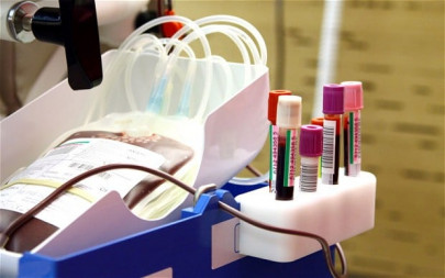 10 children get hiv from blood transfusions