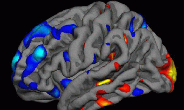 scientists use brain scans and ai to decode thoughts photo afp scientists use brain scans and ai to decode thoughts photo afp
