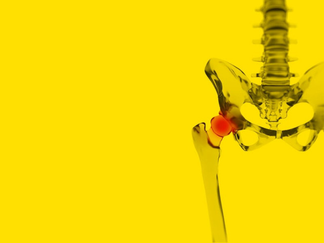 mst sheds light on arthritis the most disabling of diseases design by essa malik mst sheds light on arthritis the most disabling of diseases design by essa malik