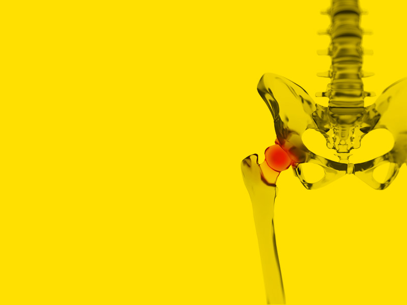 mst sheds light on arthritis the most disabling of diseases design by essa malik