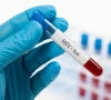3 year old tests hiv positive