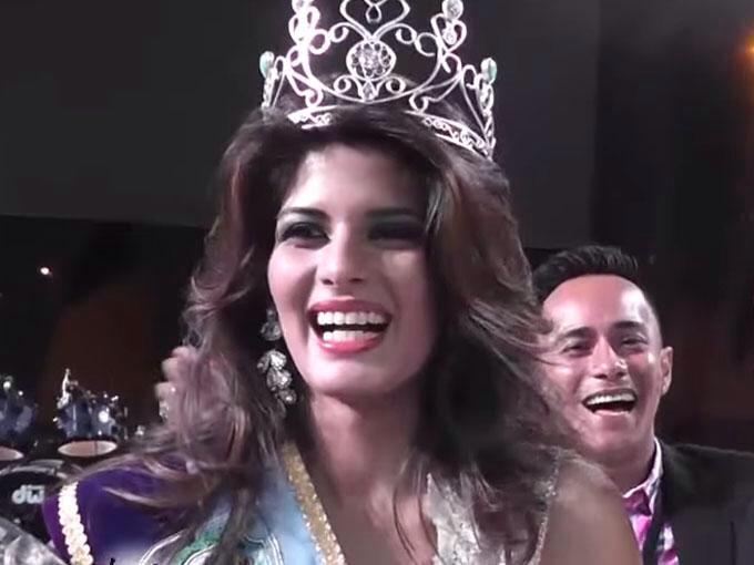 Pageant Queen dies during liposuction surgery