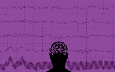 health demystifying epilepsy