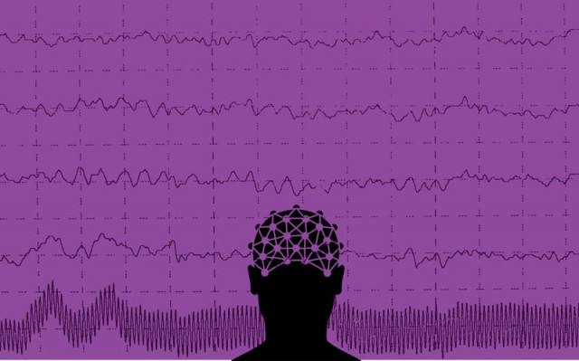 patients with epilepsy can lead normal lives if the disease is diagnosed and treated on time design omer asim patients with epilepsy can lead normal lives if the disease is diagnosed and treated on time design omer asim