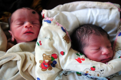 indian woman has twins despite discovery she is mostly male