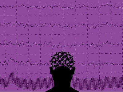 only 30 epilepsy patients get proper treatment expert only 30 epilepsy patients get proper treatment expert
