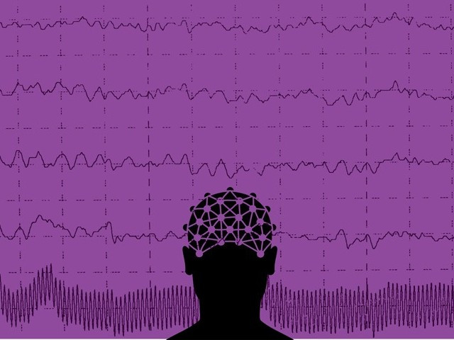 only 30 epilepsy patients get proper treatment expert only 30 epilepsy patients get proper treatment expert