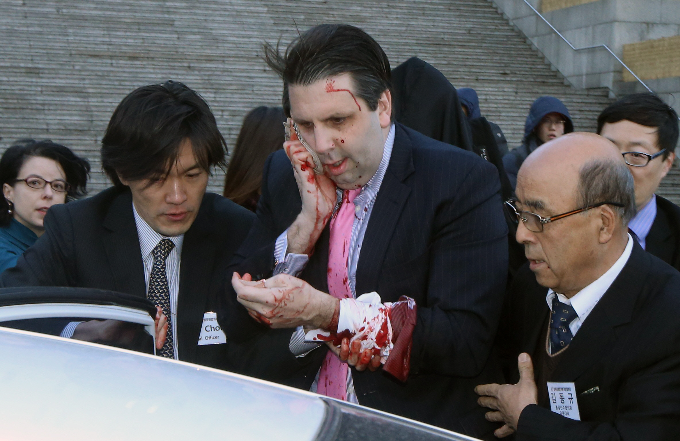 u s ambassador to south korea mark lippert leaves after he was slashed in the face by an unidentified assailant at a public forum in central seoul march 5 2015 photo reuters