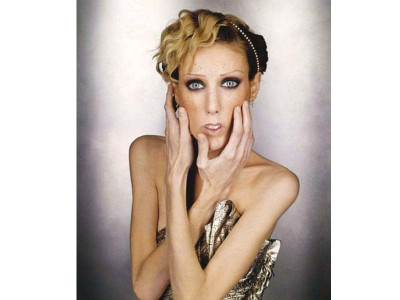 france may pass bill banning too thin models