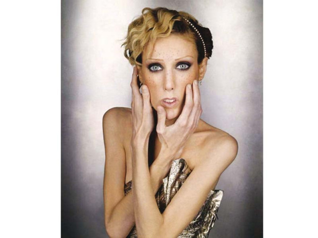 isabelle caro an anorexic former french fashion model died after posing for an awareness campaign photo the independent isabelle caro an anorexic former french fashion model died after posing for an awareness campaign photo the independent