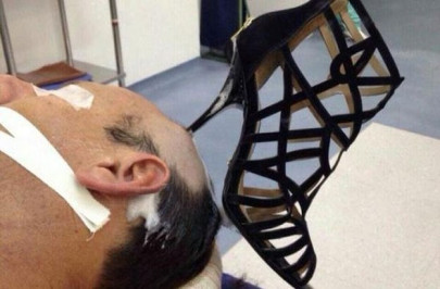 saudi man hospitalised with shoe heel lodged in his head after dispute with wife