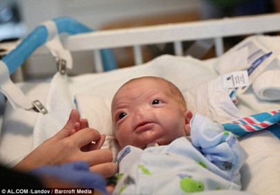 facebook removes pictures of baby born without a nose for being too controversial