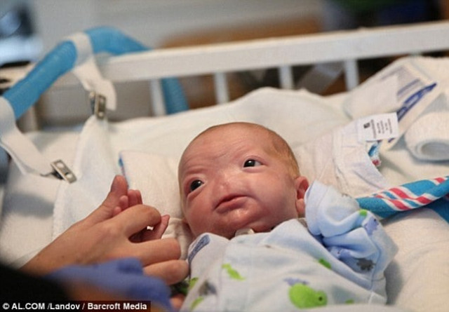 doctors hope to drill nasal passages in the boy s skull for him to be able to breathe when he is older doctors hope to drill nasal passages in the boy s skull for him to be able to breathe when he is older