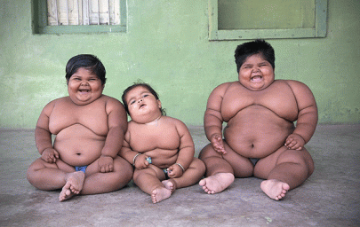 indian father plans to sell kidney to save obese children